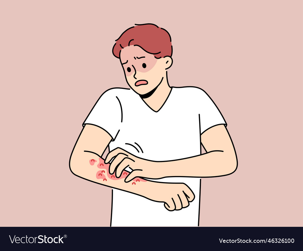 Unhealthy man scratch redness on arms Royalty Free Vector