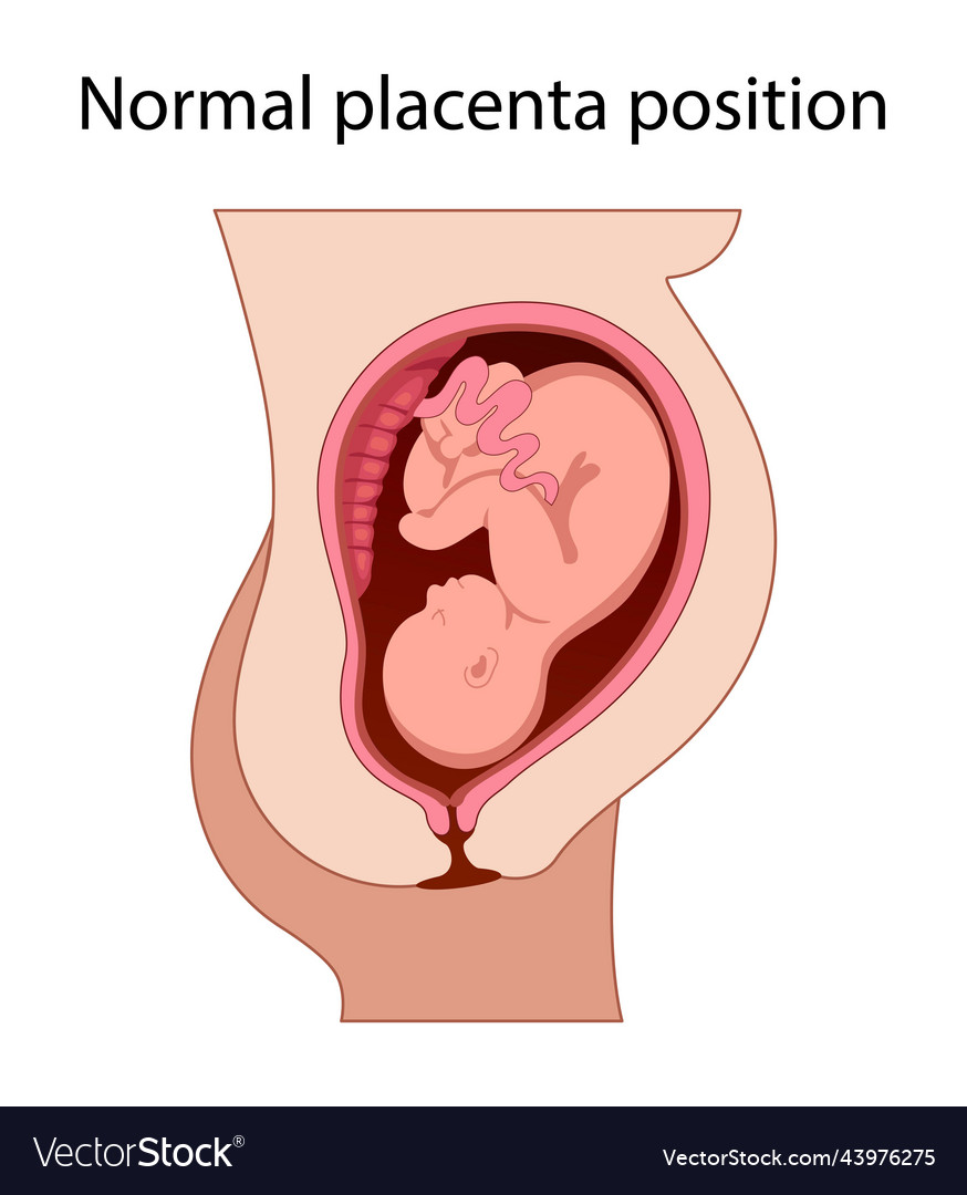 Fetus in Uterus