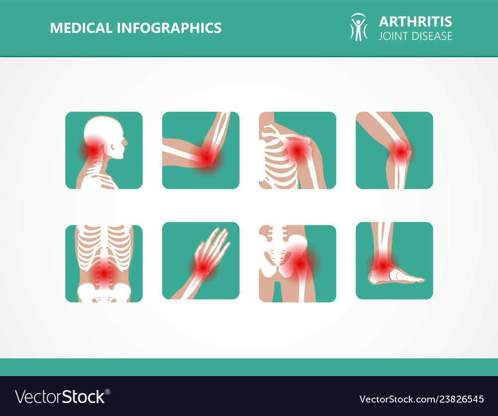 Rheumatism or rheumatic disorder medical set