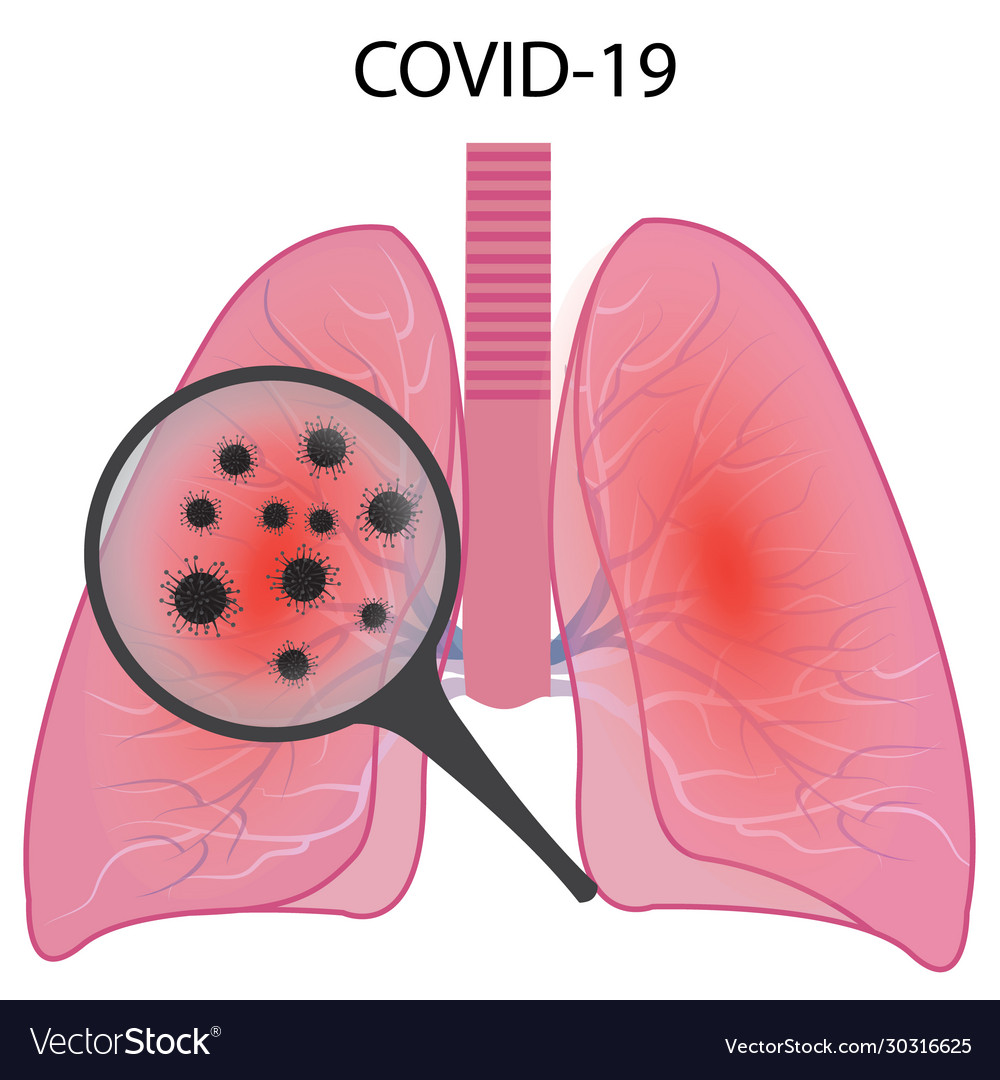 Lungs affected with coronavirus infection covid19 Vector Image