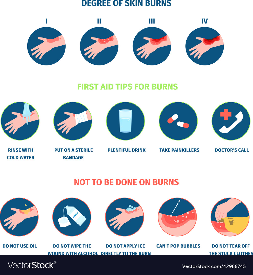 Skin burn stages infographics and treatment