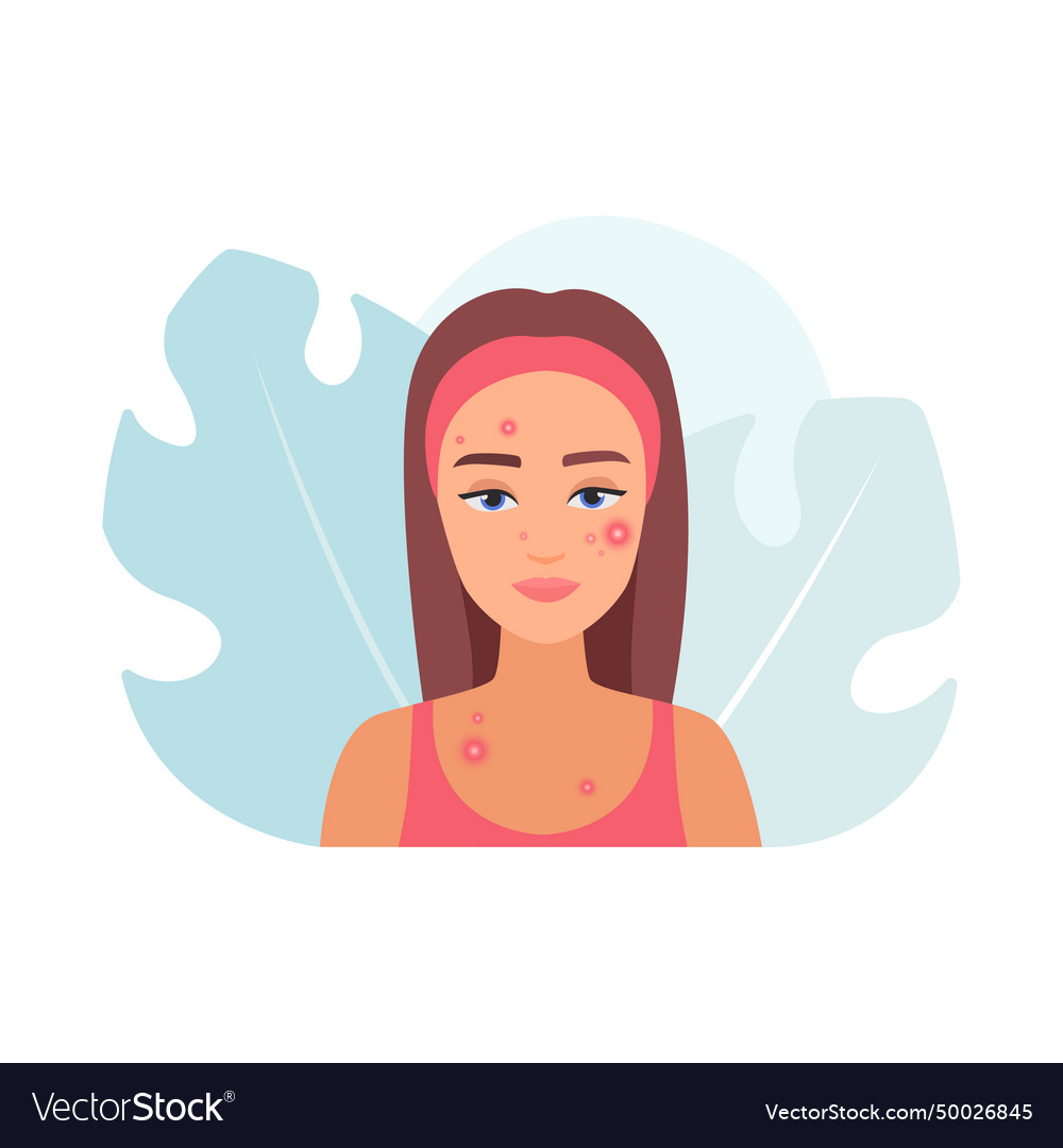 Young woman with acne puberty problem and red Vector Image