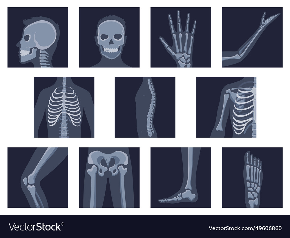 Human bones orthopedic and skeleton icon set bone