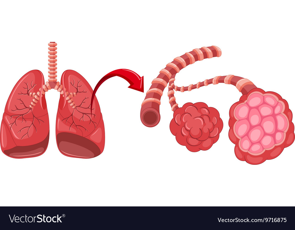 Pneumonia Diagram With Zoom In Lungs Royalty Free Vector