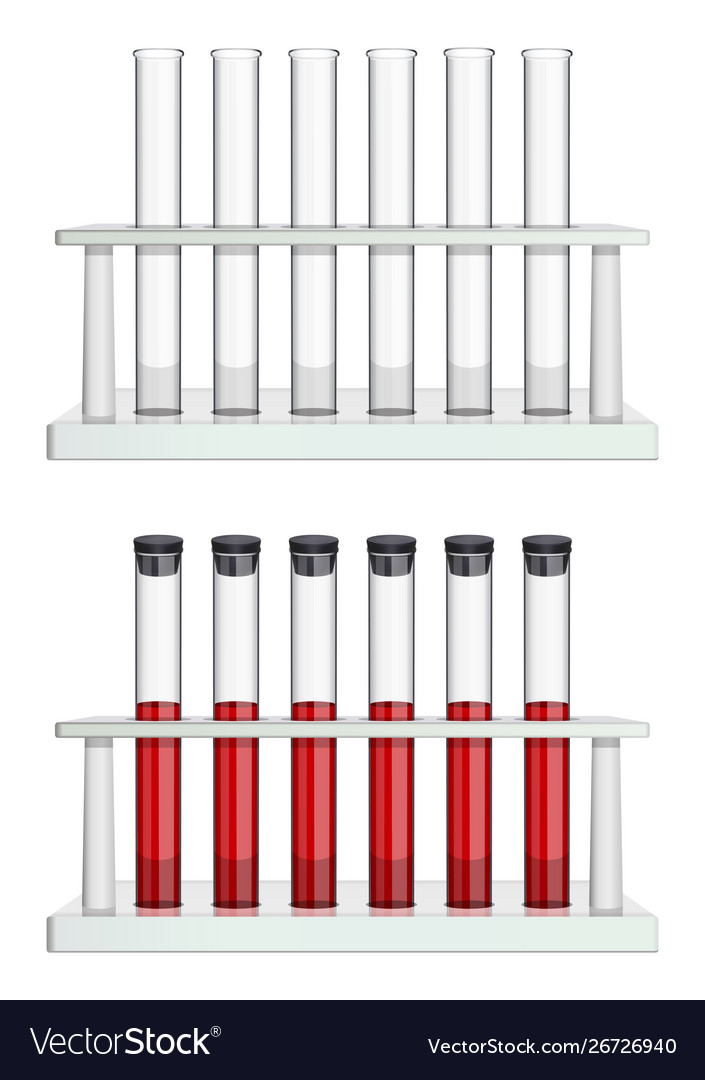 A set test tubes in racks empty and blood