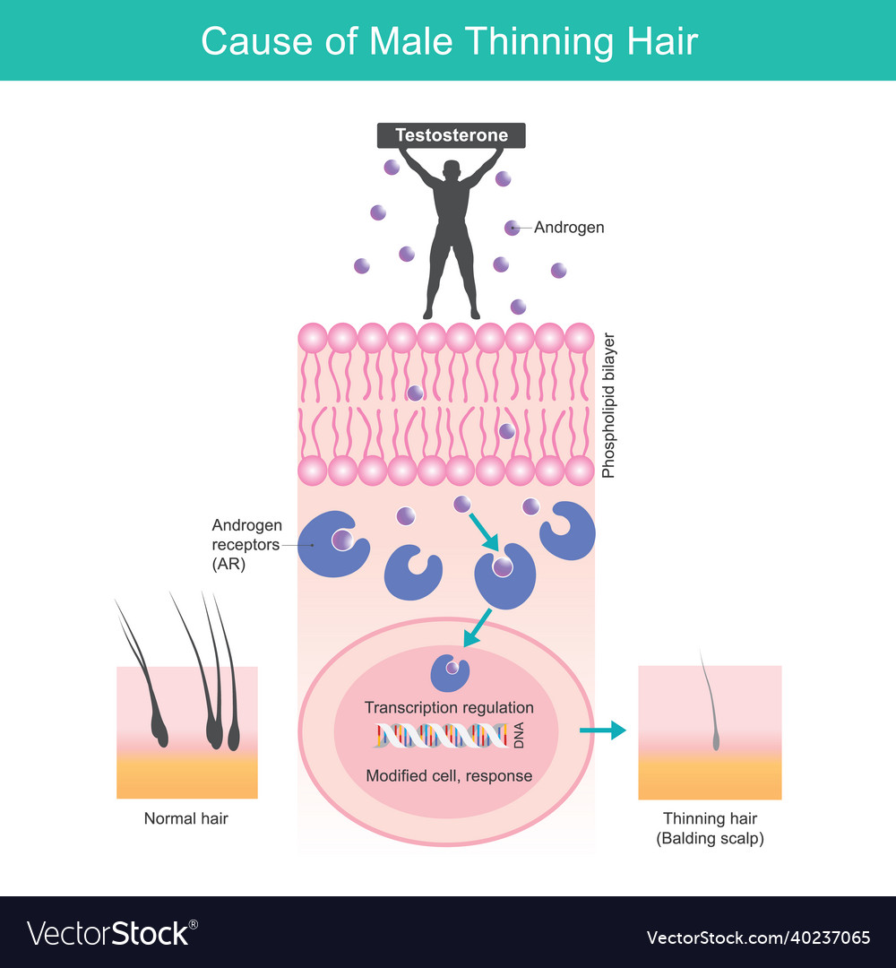 Cause of male thinning hair for explain problem