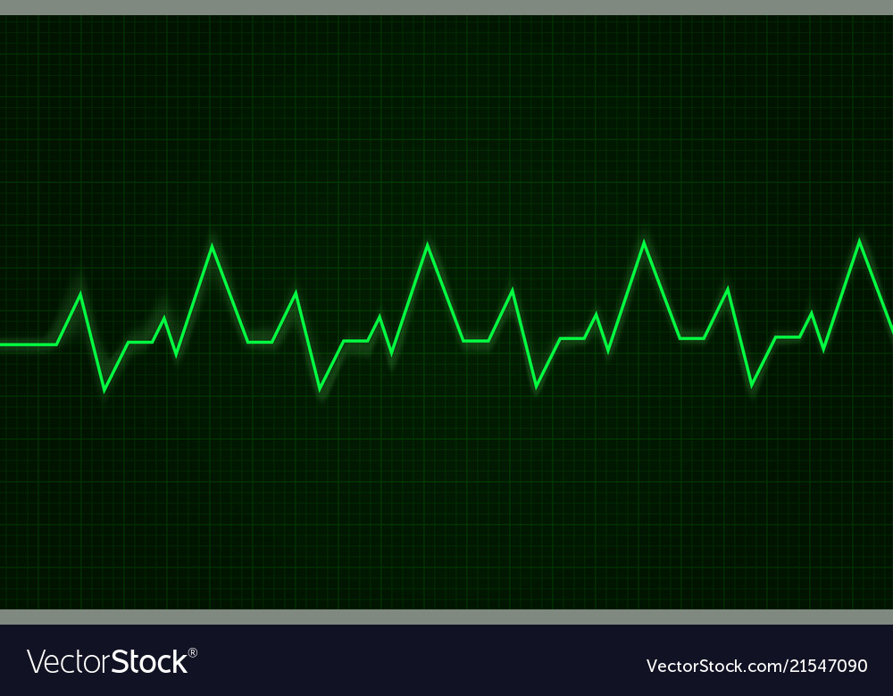Heartbeat cardiogram graph green line on display