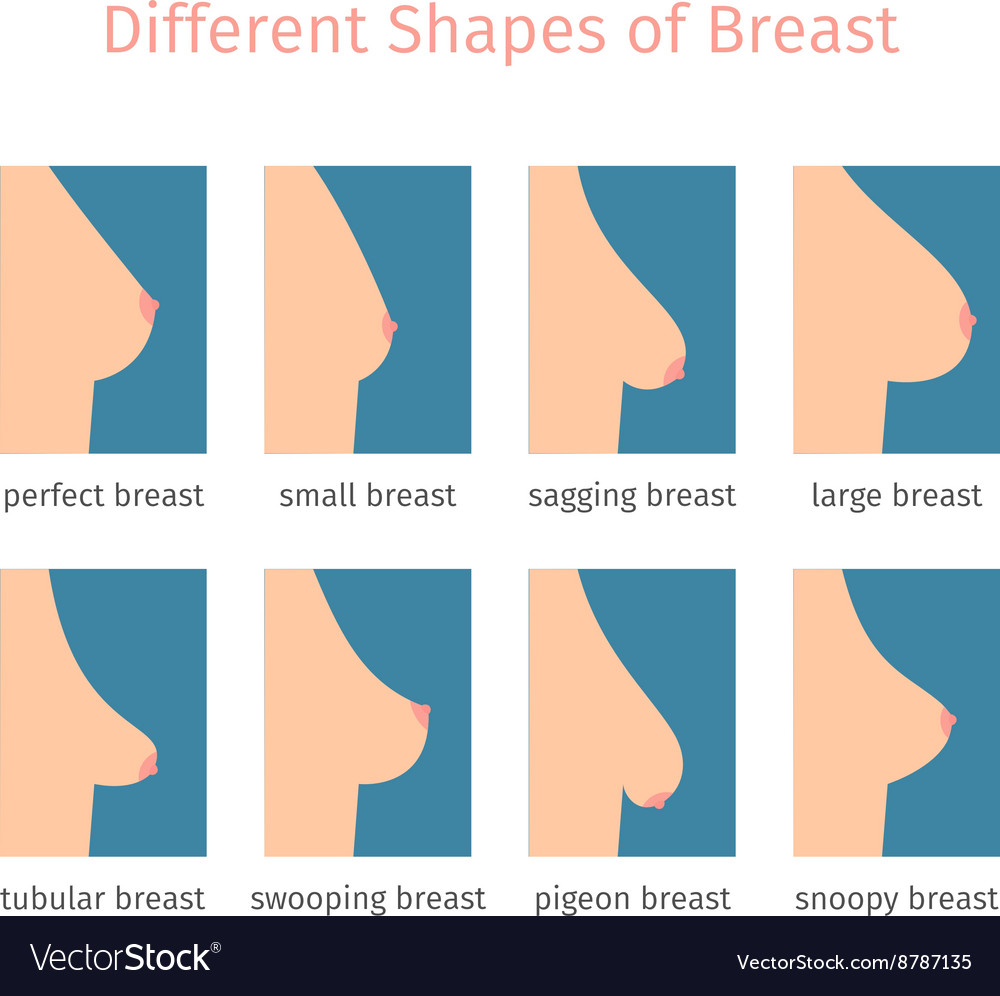 Breast Shape And Size Chart