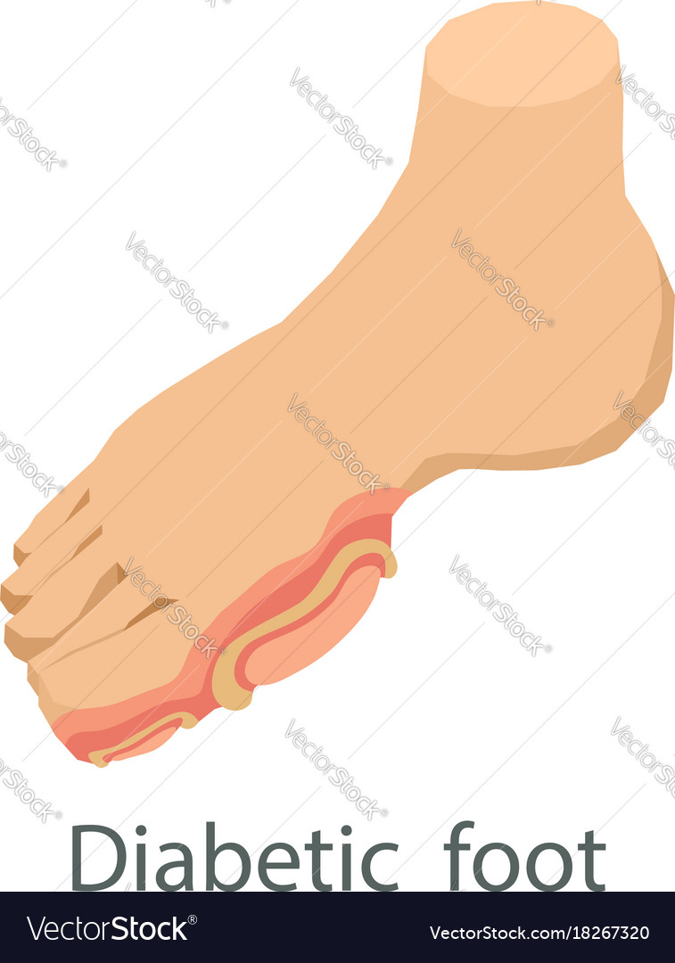 Diabetic foot icon isometric style Royalty Free Vector Image