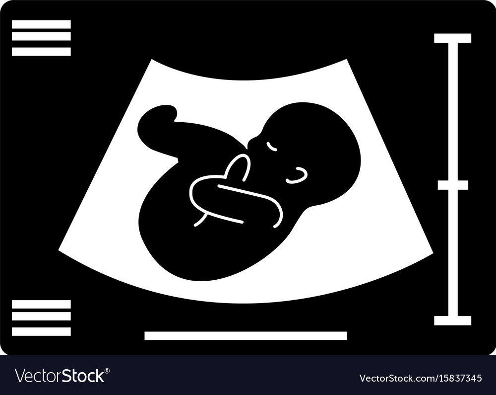 Ultrasound monitor isolated icon Royalty Free Vector Image