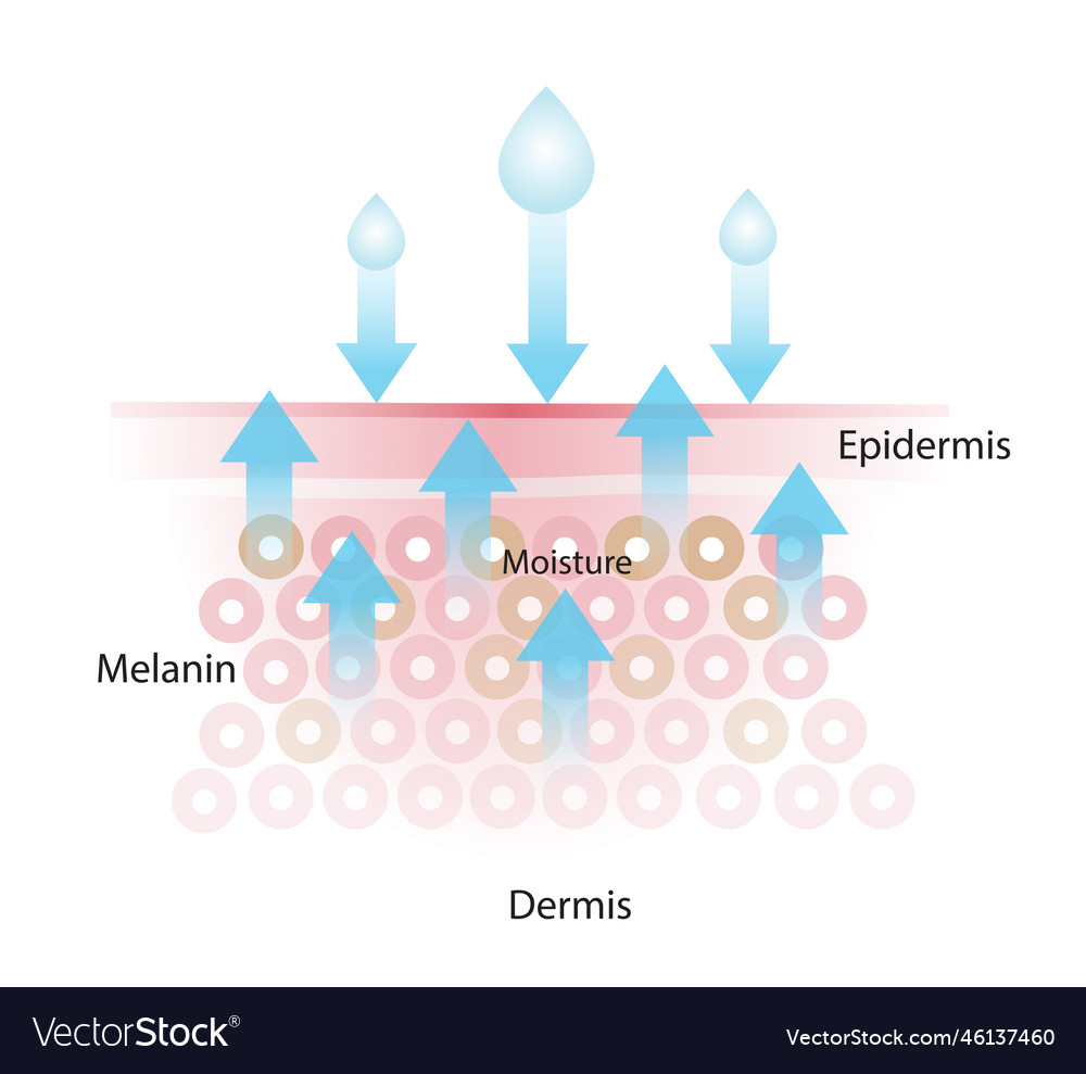 Loss of skin moisture Royalty Free Vector Image