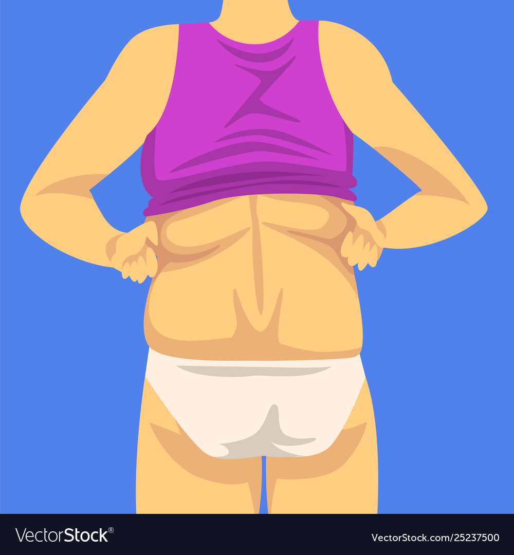 Weibliche Figur - Fettleibigkeit und Gewichtsverlust