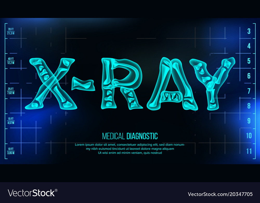 X Ray Banner Medical Background Royalty Free Vector Image