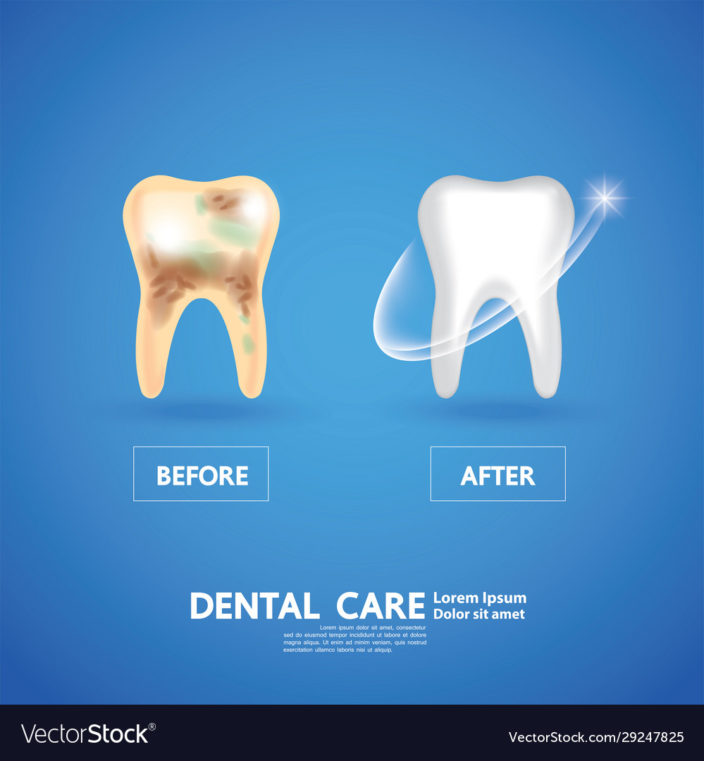 Dental care creative concept Royalty Free Vector Image