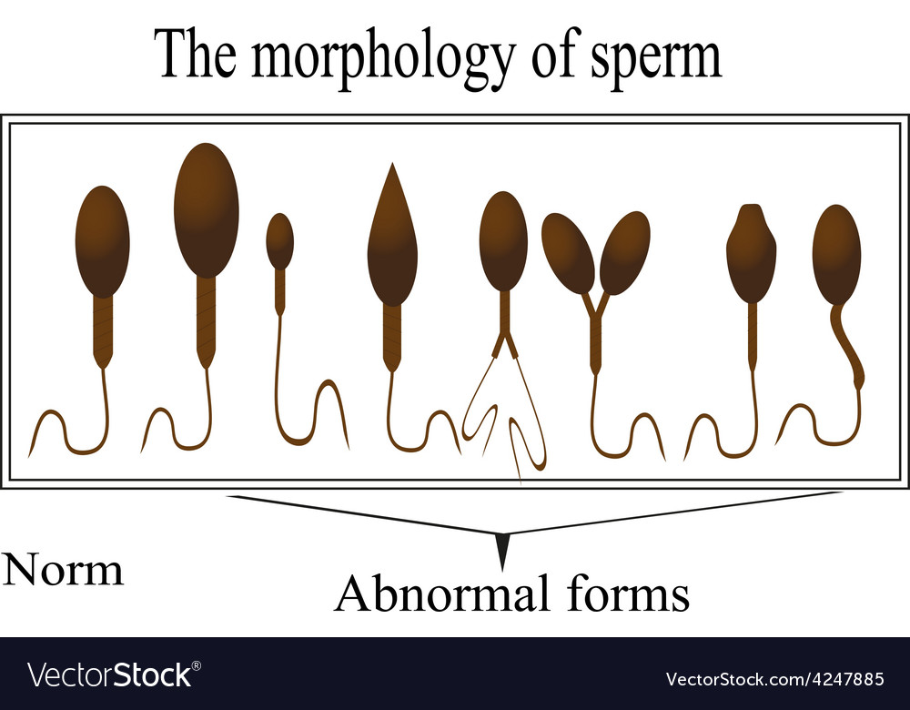 The morphology of the sperm Normal and abnormal Vector Image