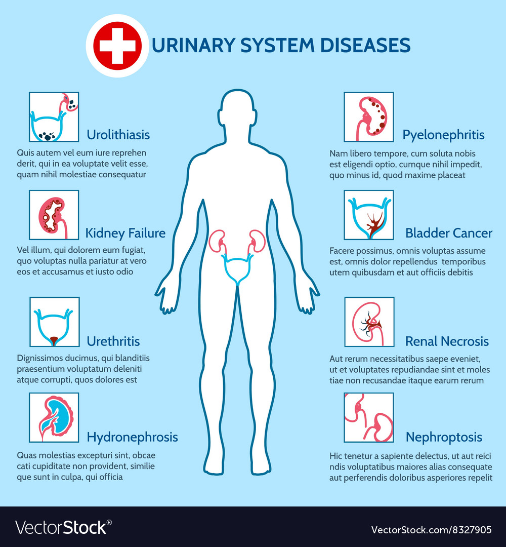 Urinary System Diseases Royalty Free Vector Image 5557