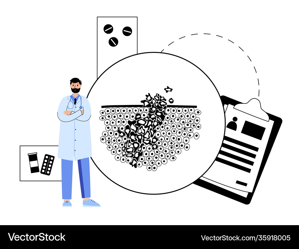 Tumor cells concept Royalty Free Vector Image - VectorStock