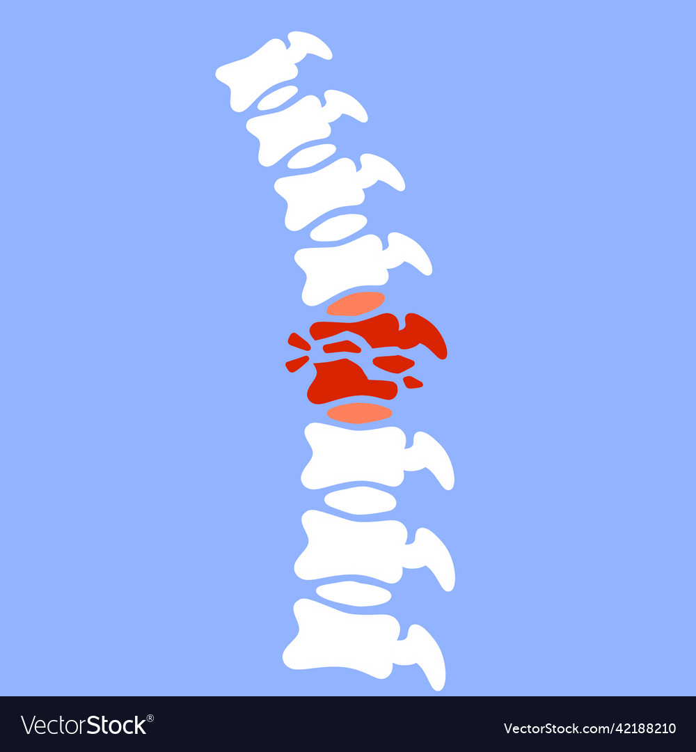 Problems with spine posture issues vector image Problems with spine posture issues