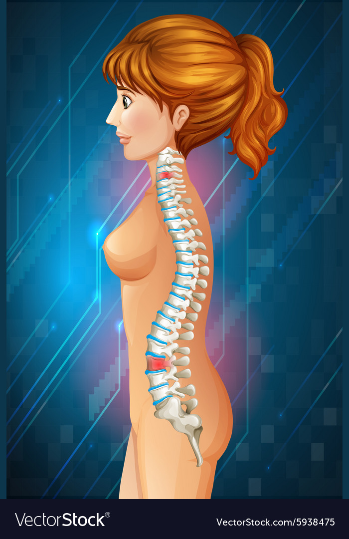 Spine diagram showing back pain