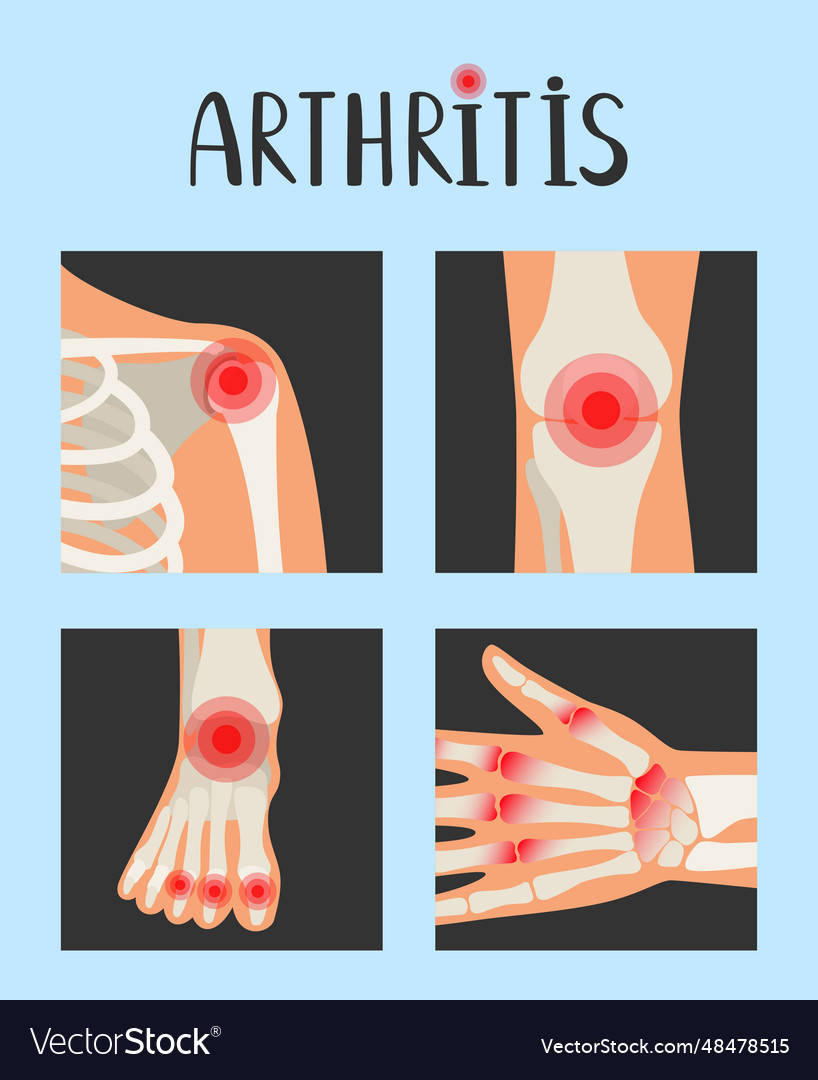 Joints of the human skeleton with pain red dots