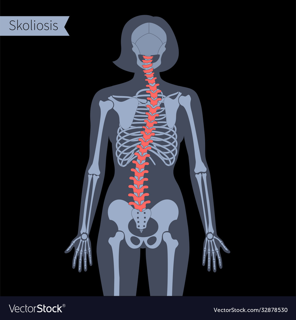 Spine x ray