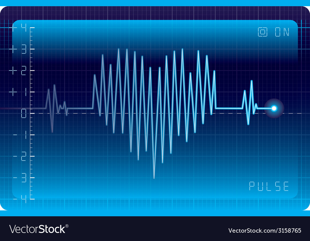 Ekg heart