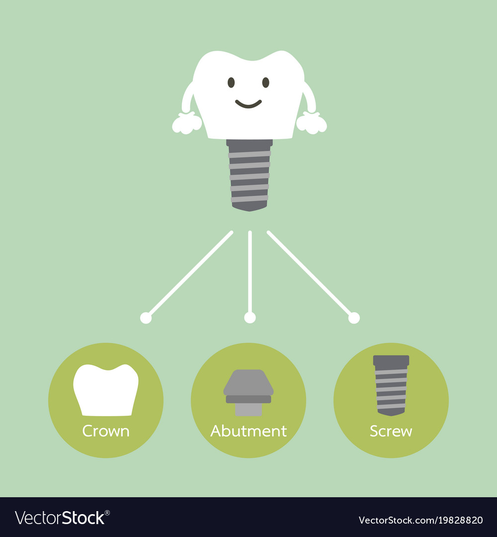 Structure of the dental implant with all parts