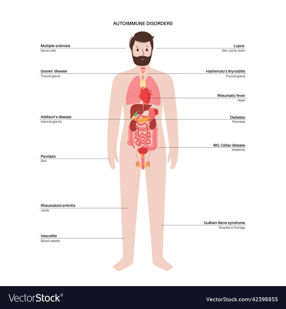 Autoimmune disorders diseases