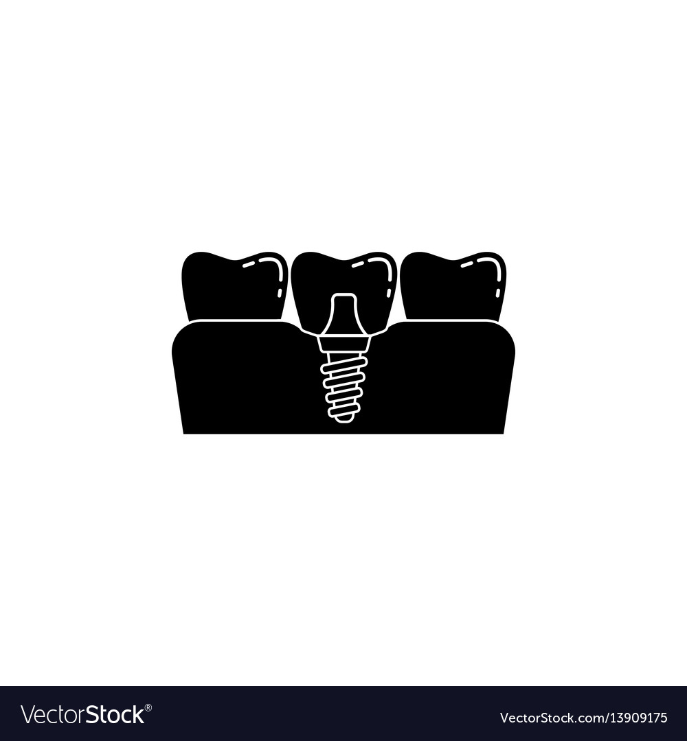 Dental implant solid icon Royalty Free Vector Image