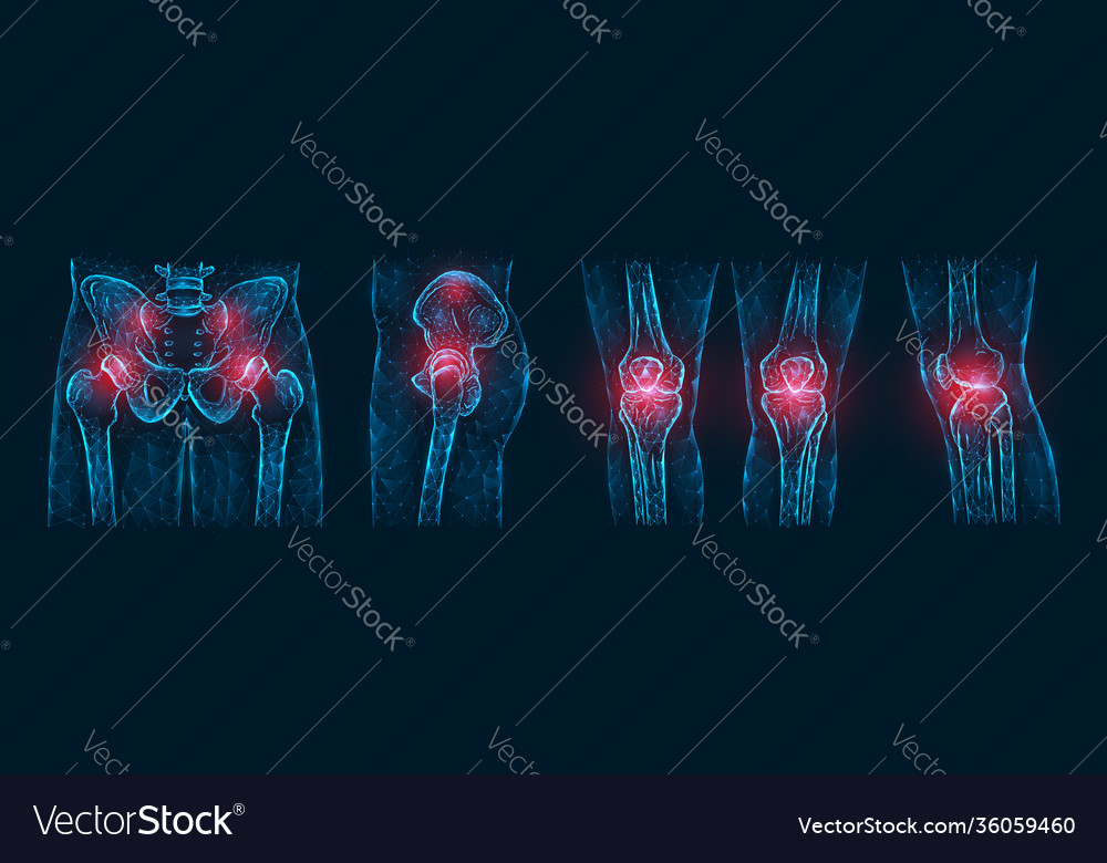 Polygonal pain or inflammation bones Royalty Free Vector