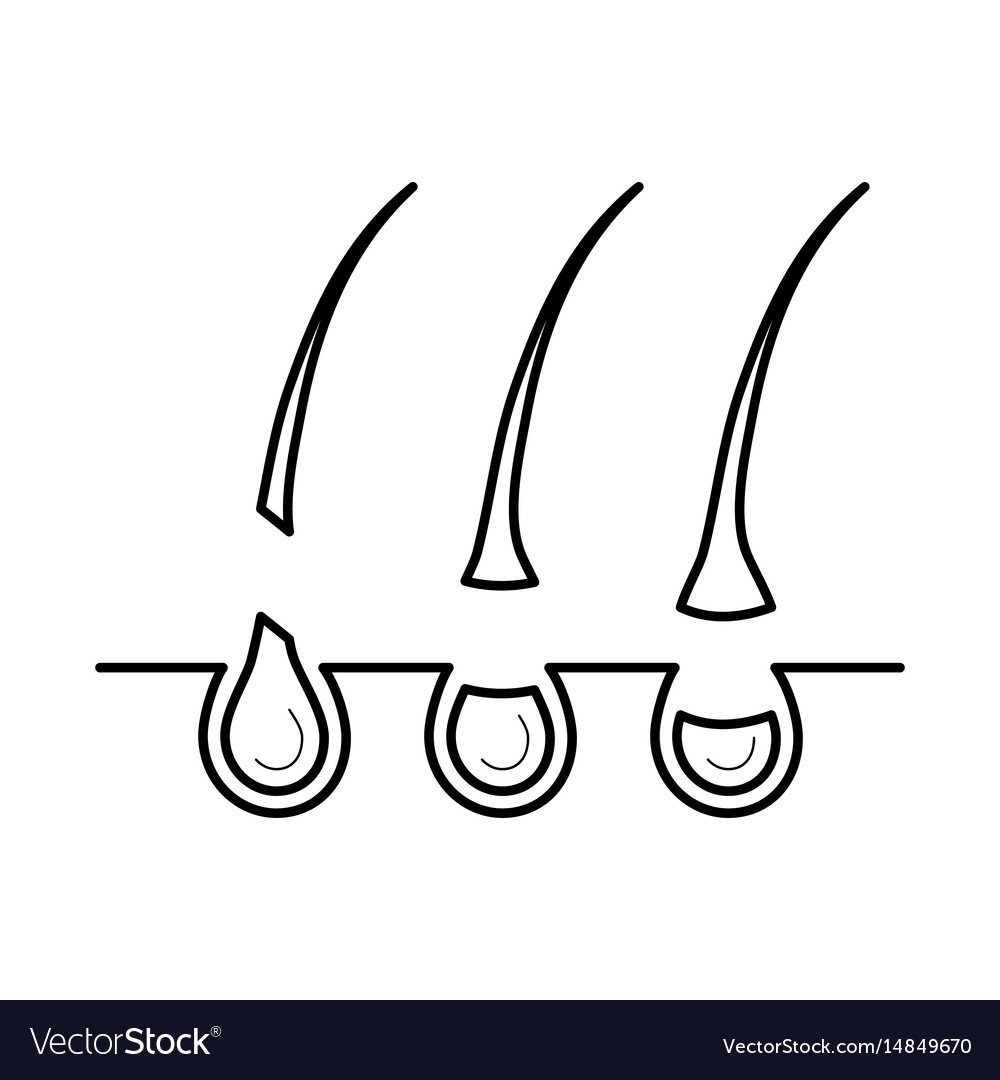 Hair Removed From The Skin Surface Without Bulb Vector Image