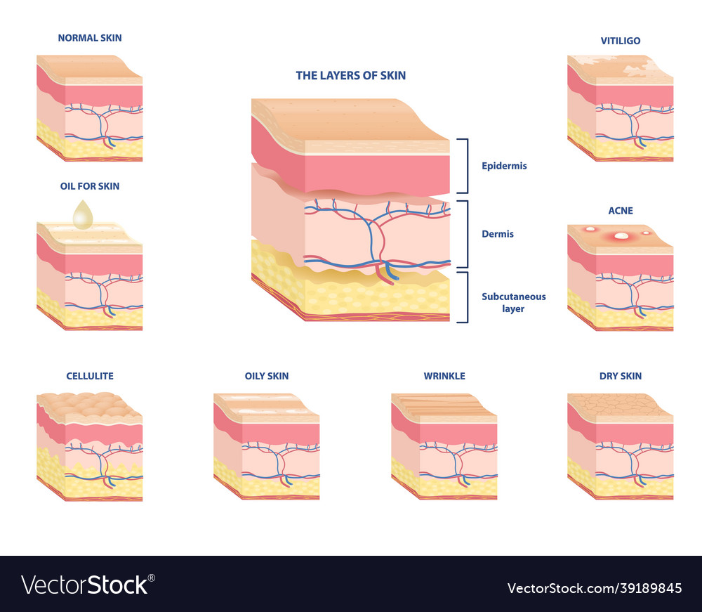 Collection of schemes of various skin types Vector Image