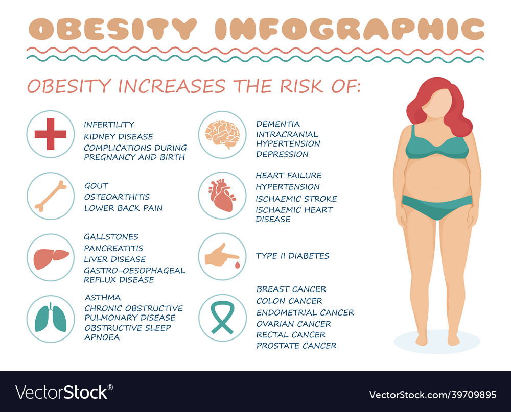 Obesity syndrome medical infographic Royalty Free Vector