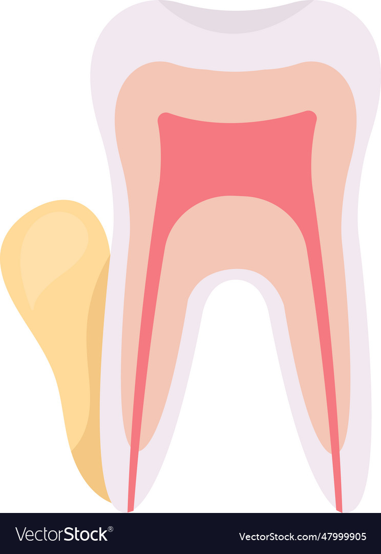 Flux tooth problem Royalty Free Vector Image - VectorStock