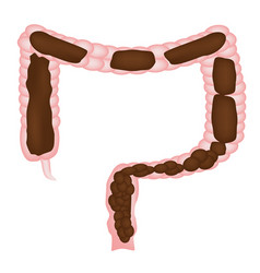 Bowel Cute Colon Vector Images (25)