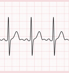 Electrocardiogram Vector Images (over 5,700)