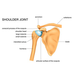 Types of endoprostheses by type of material Vector Image