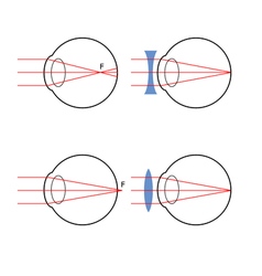 Human eye structure scheme medical Royalty Free Vector Image