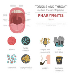 Tonsils and throat diseases pharyngitis symptoms Vector Image