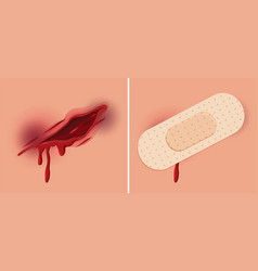 Isolated hand open wound Royalty Free Vector Image