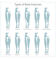 Bone structure medical educational Royalty Free Vector Image