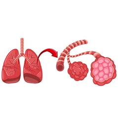 Lung diagram with pneumonia Royalty Free Vector Image