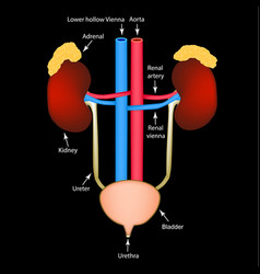 Cystitis inflammation bladder Royalty Free Vector Image
