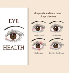 Glaucoma Ophthalmology Vector Images (over 420)