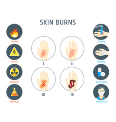 Skin burn three degrees of burns type of injury Vector Image