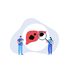 Liver disease concept Royalty Free Vector Image