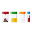 test tubes with caps stool blood urine sperm vector image