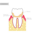 isolated tooth vector image vector image