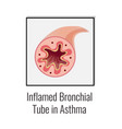 asthma inflamed tube composition vector image vector image
